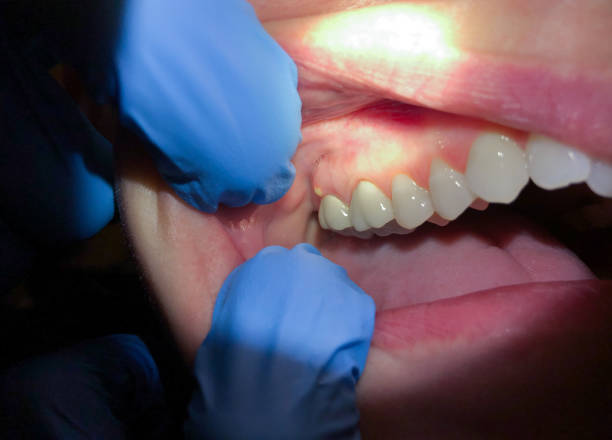 Best Emergency Dentist for Special Needs Patients in Lake Station, IN